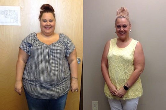 Weight Loss Surgery Brings New Level of Confidence